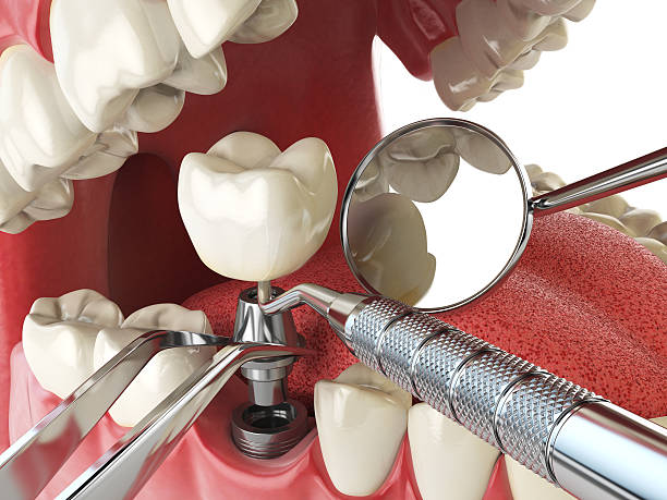 Best Urgent Tooth Repair  in Greenfield, IL